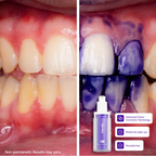 Hismile V34 Colour Corrector Serum – Instant Teeth Brightener