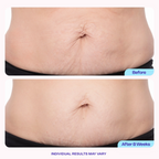 Tighten & Smooth Belly Firming Cream – MicroTight4 Complex