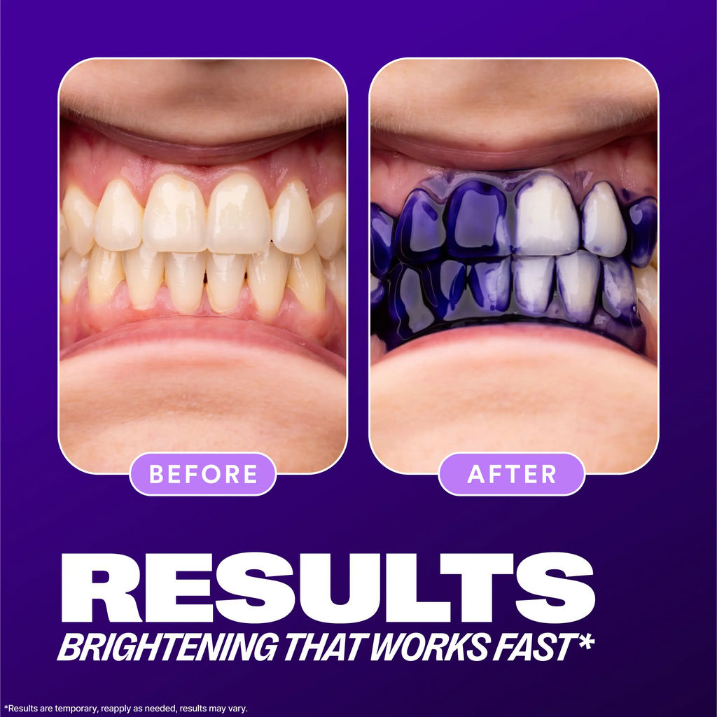 Hismile V34 Colour Corrector Serum – Instant Teeth Brightener