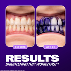 Hismile V34 Colour Corrector Serum – Instant Teeth Brightener