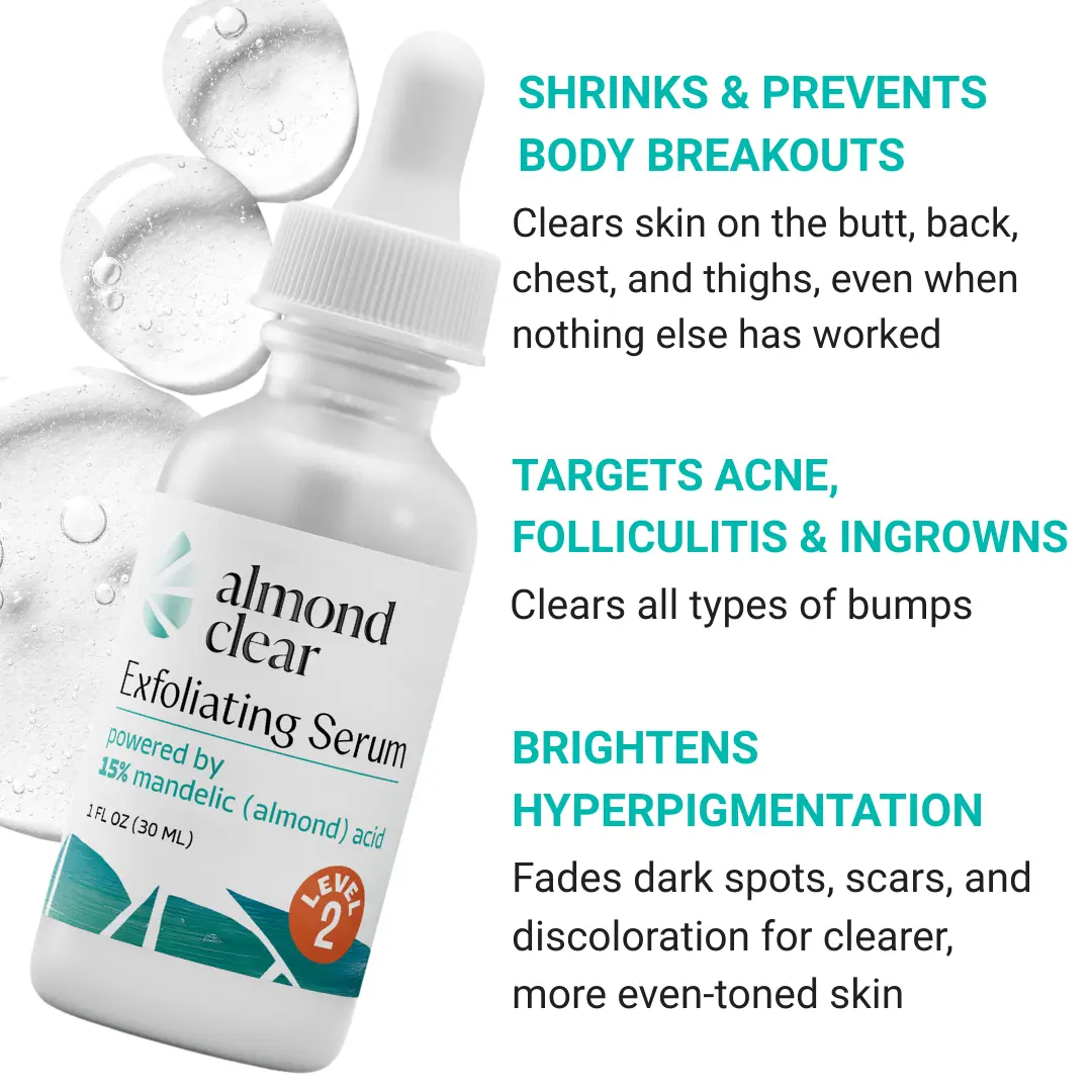 Almond Clear Level 2 Mandelic Acid Body Serum – 15% Body Acne Treatment